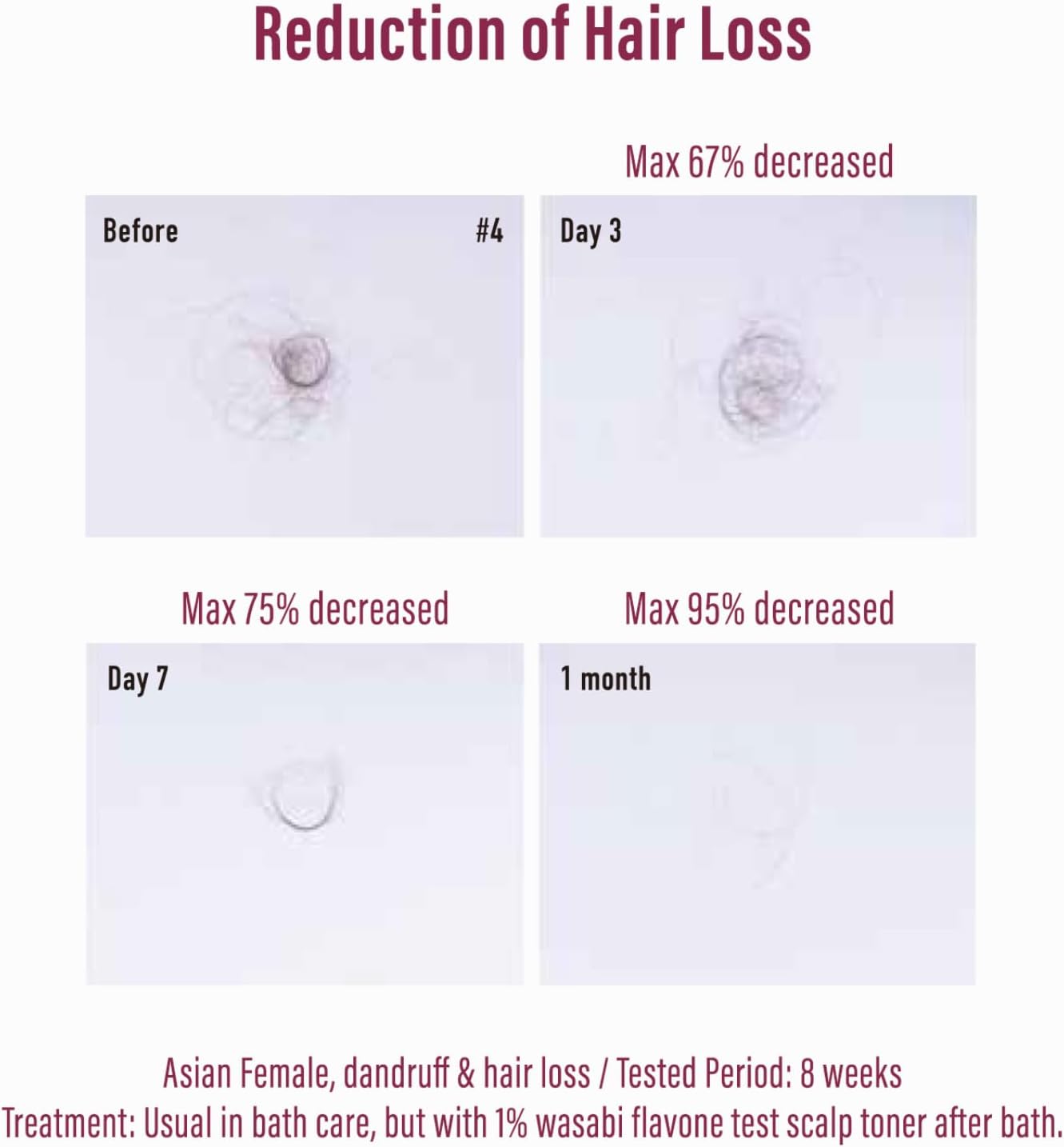 NatureLab Diane Perfect Beauty Extra Hair Fall Control Treatment [450ml] 